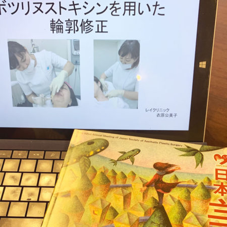 ボトックスのプレゼン